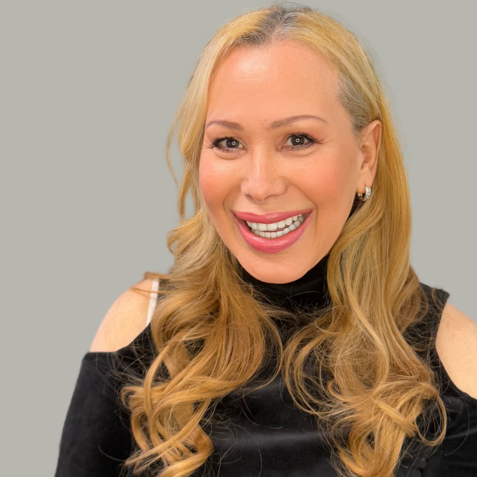 Smile Transformation 3