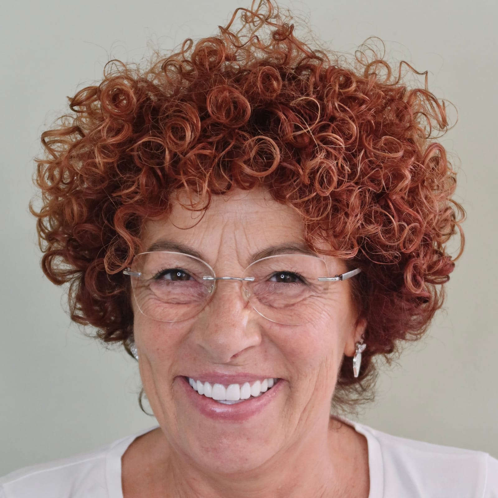 Smile Transformation 6